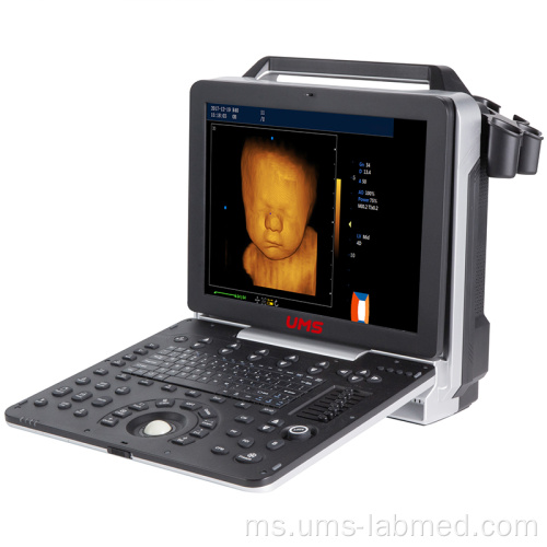 Pengimbas Ultrasound 4D Doppler Warna Mudah Alih UW-P6